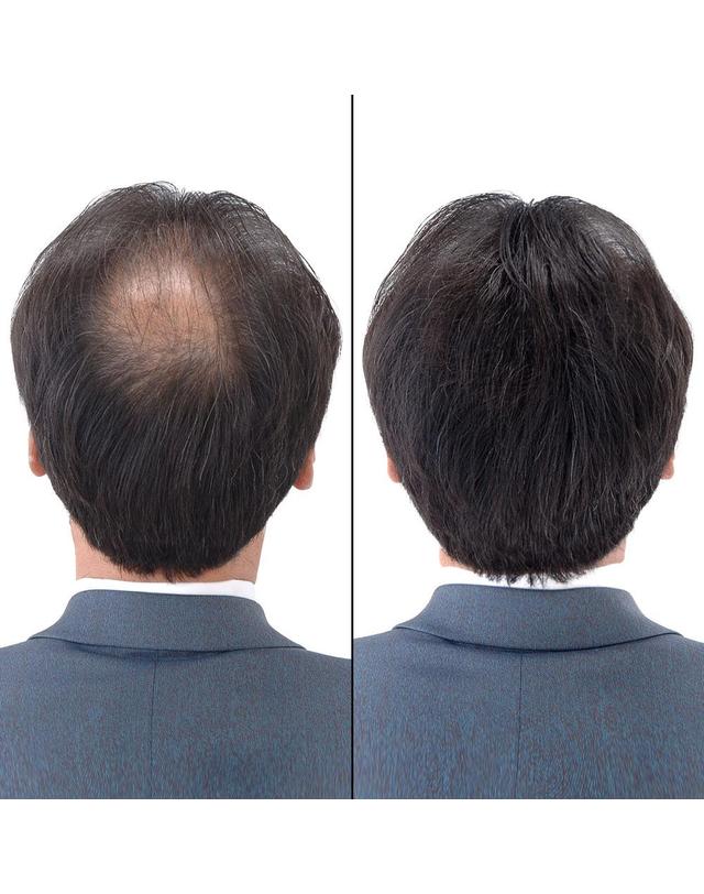 슈퍼밀리언헤어 슈퍼밀리언헤어 흑채 25g 블랙 착용컷